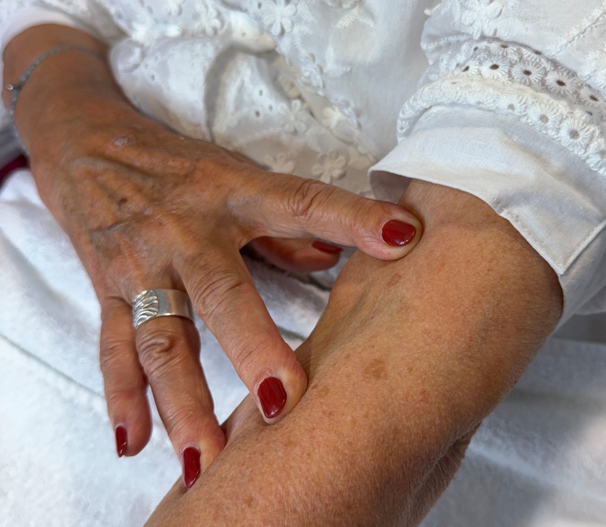 Voor en na – "Als de liefde nietalles overleeft"