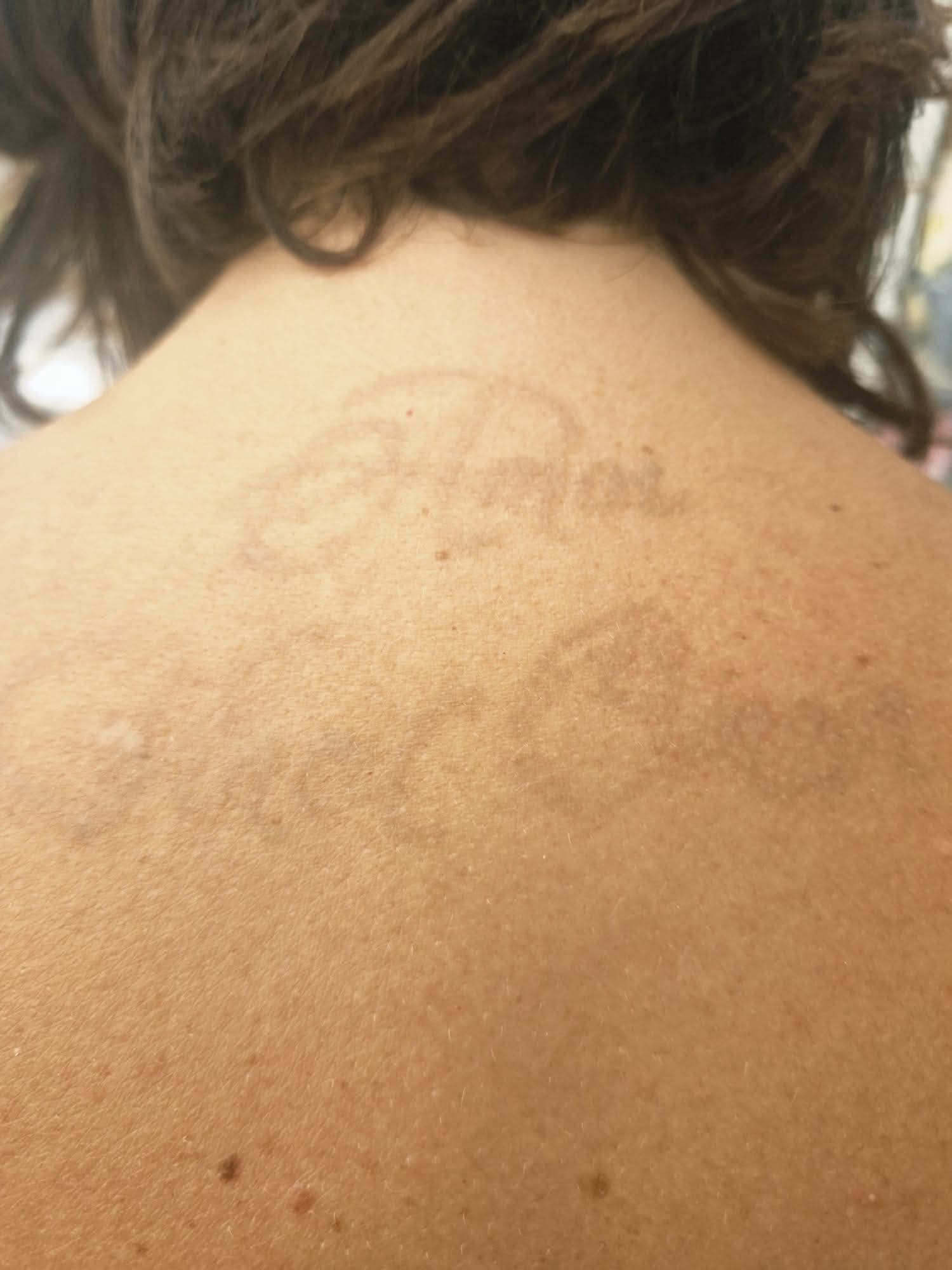 Voor en na – "Als de liefde nietalles overleeft"